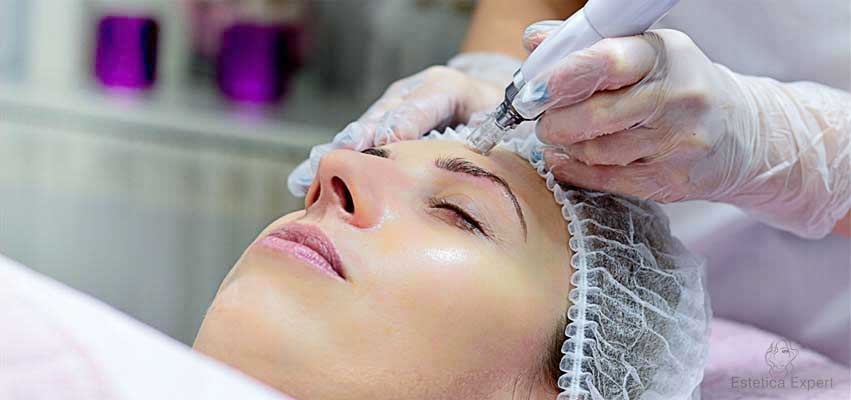 kosmetische microneedlingbehandlungen in unserem Schönheitssalon in München